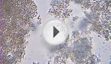 Milk Kefir mycroscopy under a Bresser Microscope